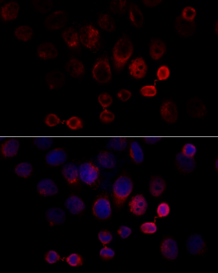 Immunofluorescence analysis of HeLa cells using Caspase-3 Polyclonal Antibody at dilution of  1:100 (40x lens). Blue: DAPI for nuclear staining.