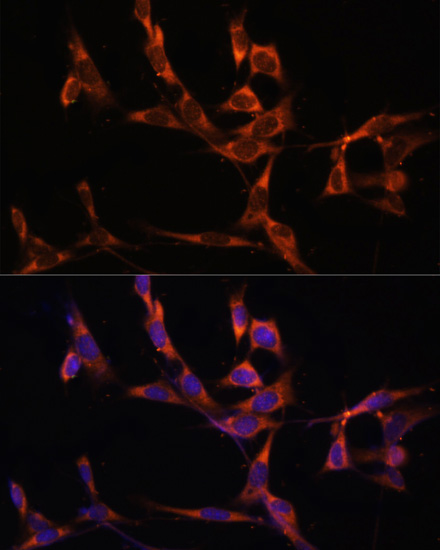 Immunofluorescence analysis of NIH/3T3 cells using Caspase-8 Polyclonal Antibody at dilution of  1:100. Blue: DAPI for nuclear staining.