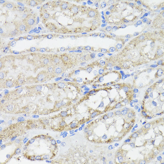Immunohistochemistry of paraffin-embedded Mouse kidney using Caspase-8 Polyclonal Antibody at dilution of  1:200 (40x lens).