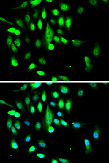Immunofluorescence analysis of A549 cells using CDK1 Polyclonal Antibody