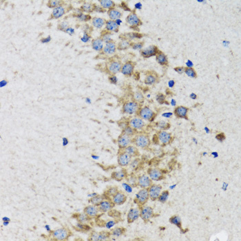Immunohistochemistry of paraffin-embedded Rat brain using CDK1 Polyclonal Antibody at dilution of  1:100 (40x lens).