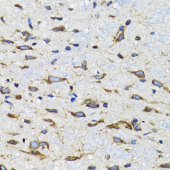 Immunohistochemistry of paraffin-embedded Mouse spinal cord using CDK1 Polyclonal Antibody at dilution of  1:100 (40x lens).