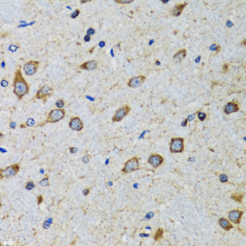 Immunohistochemistry of paraffin-embedded Mouse brain using CDK1 Polyclonal Antibody at dilution of  1:100 (40x lens).