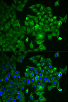 Immunofluorescence analysis of U2OS cells using RAF1 Polyclonal Antibody