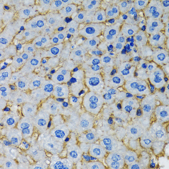 Immunohistochemistry of paraffin-embedded Rat liver using RAF1 Polyclonal Antibody at dilution of  1:100 (40x lens).