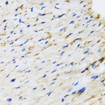 Immunohistochemistry of paraffin-embedded Rat heart using RAF1 Polyclonal Antibody at dilution of  1:100 (40x lens).