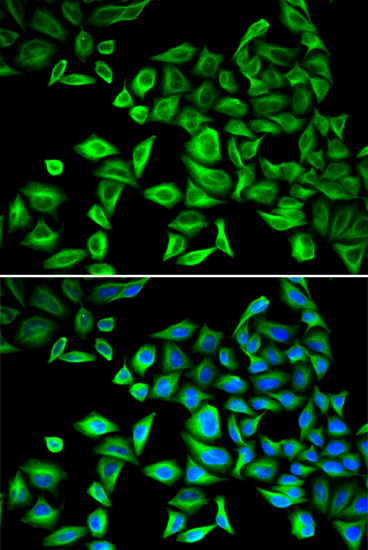 Immunofluorescence analysis of HeLa cells using CRP Polyclonal Antibody