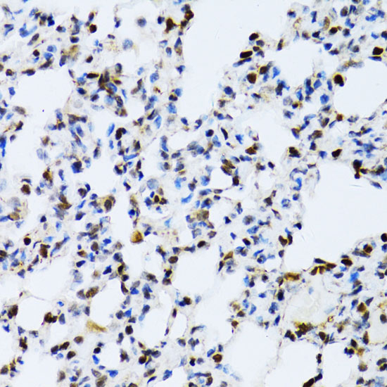 Immunohistochemistry of paraffin-embedded Rat lung using MAPK3 Polyclonal Antibody at dilution of  1:100 (40x lens).