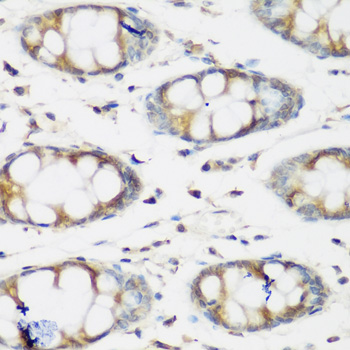 Immunohistochemistry of paraffin-embedded Human colon using BMP2 Polyclonal Antibody at dilution of  1:200 (40x lens).