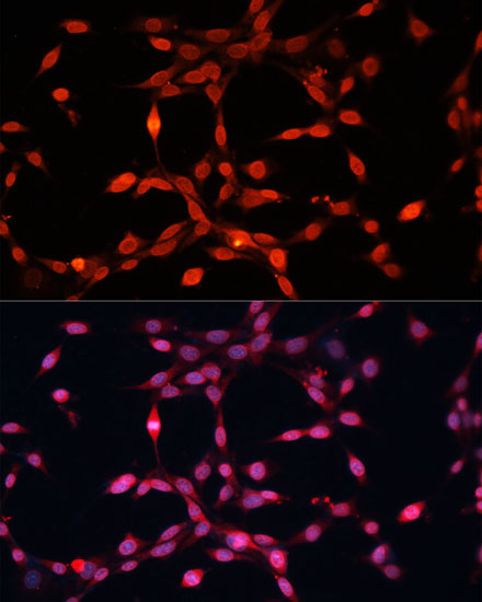 Immunofluorescence analysis of NIH-3T3 cells using FGF2 Polyclonal Antibody at dilution of  1:100 (40x lens). Blue: DAPI for nuclear staining.