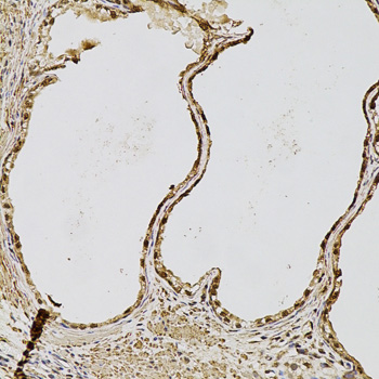 Immunohistochemistry of paraffin-embedded Human prostate using FGF2 Polyclonal Antibody at dilution of  1:100 (20x lens).