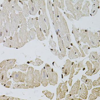 Immunohistochemistry of paraffin-embedded Mouse heart using FGF2 Polyclonal Antibody at dilution of  1:100 (40x lens).