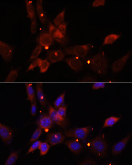 Immunofluorescence analysis of NIH/3T3 cells using IKBKE Polyclonal Antibody at dilution of  1:100. Blue: DAPI for nuclear staining.