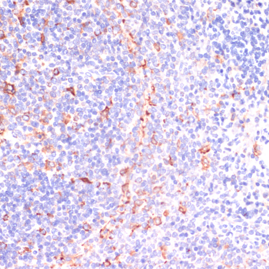 Immunohistochemistry of paraffin-embedded Rat spleen using IKBKE Polyclonal Antibody at dilution of  1:200 (40x lens).