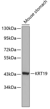 Western blot analysis of extracts of Mouse stomach using KRT19 Polyclonal Antibody at dilution of 1:1000.