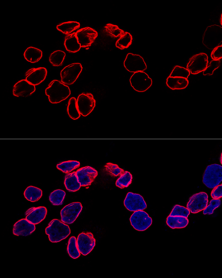 Confocal immunofluorescence analysis of A-431 cells using Lamin A/C Polyclonal Antibody at dilution of  1:200. Blue: DAPI for nuclear staining.