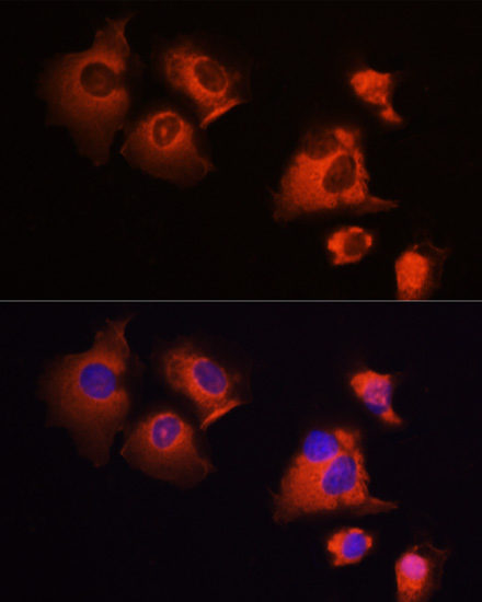 Immunofluorescence analysis of A431 cells using MCL1 Polyclonal Antibody at dilution of  1:100 (40x lens). Blue: DAPI for nuclear staining.