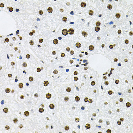 Immunohistochemistry of paraffin-embedded Mouse liver using MCL1 Polyclonal Antibody at dilution of  1:100 (40x lens).