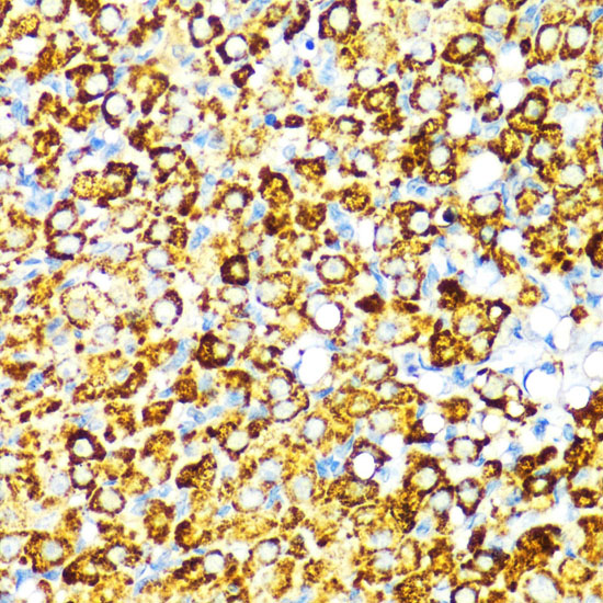 Immunohistochemistry of paraffin-embedded Rat ovary using PBEF / NAMPT Polyclonal Antibody at dilution of  1:100 (40x lens).