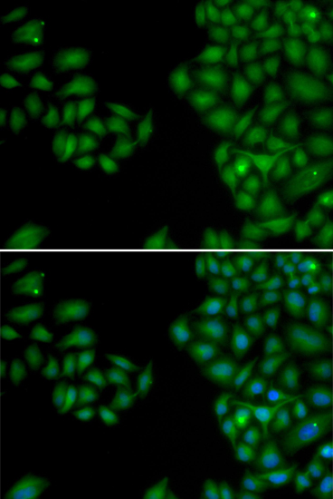 Immunofluorescence analysis of HeLa cells using NEFL Polyclonal Antibody