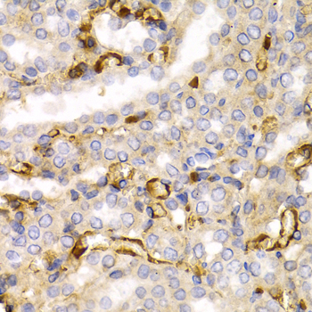 Immunohistochemistry of paraffin-embedded Rat kidney using NEFL Polyclonal Antibody at dilution of  1:200 (40x lens).