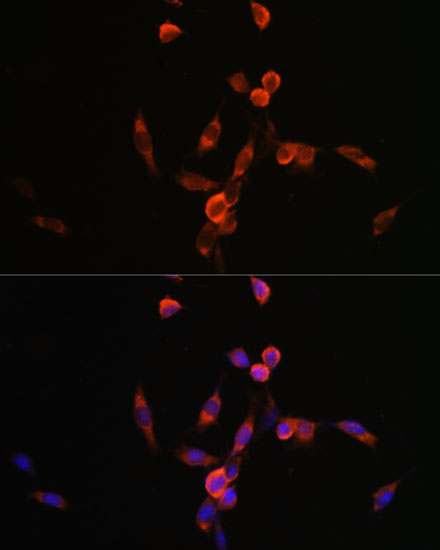 Immunofluorescence analysis of NIH/3T3 cells using PIK3CA Polyclonal Antibody at dilution of  1:100. Blue: DAPI for nuclear staining.