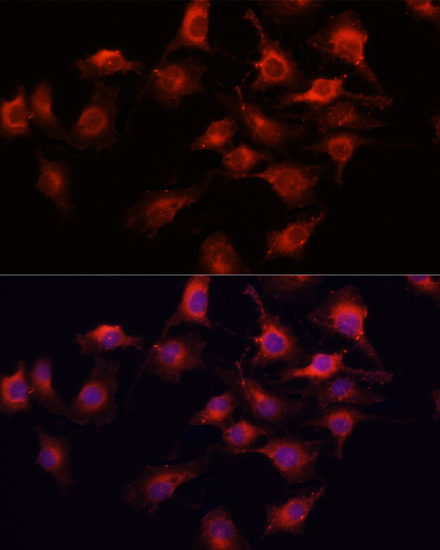 Immunofluorescence analysis of HUVEC cells using VEGFA Polyclonal Antibody at dilution of  1:100 (40x lens). Blue: DAPI for nuclear staining.