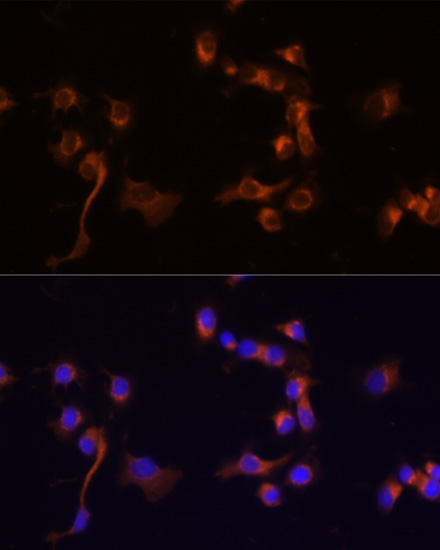 Immunofluorescence analysis of A431 cells using ABL1 Polyclonal Antibody at dilution of  1:100 (40x lens). Blue: DAPI for nuclear staining.