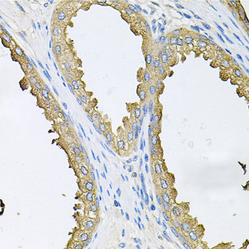 Immunohistochemistry of paraffin-embedded Human prostate using ABL1 Polyclonal Antibody at dilution of  1:100 (40x lens).