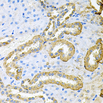 Immunohistochemistry of paraffin-embedded Rat kidney using ABL1 Polyclonal Antibody at dilution of  1:100 (40x lens).