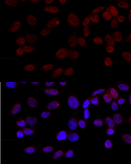 Immunofluorescence analysis of HeLa cells using JNK1 Polyclonal Antibody at dilution of  1:100 (40x lens). Blue: DAPI for nuclear staining.