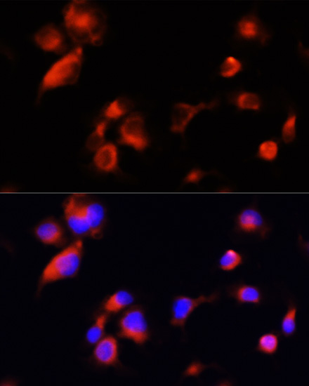 Immunofluorescence analysis of A431 cells using APOE Polyclonal Antibody at dilution of  1:100 (40x lens). Blue: DAPI for nuclear staining.