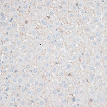 Immunohistochemistry of paraffin-embedded Rat liver using N-Cadherin Polyclonal Antibody at dilution of  1:100 (40x lens).