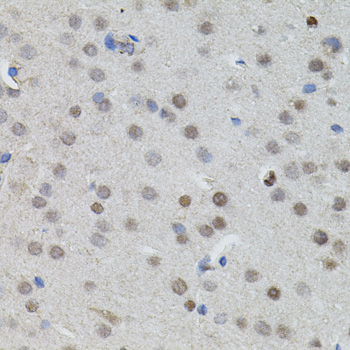 Immunohistochemistry of paraffin-embedded Mouse brain using MYCN Polyclonal Antibody