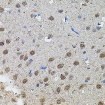 Immunohistochemistry of paraffin-embedded Rat brain using MYCN Polyclonal Antibody