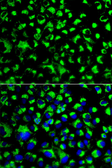 Immunofluorescence analysis of U2OS cells using HSPA9 Polyclonal Antibody