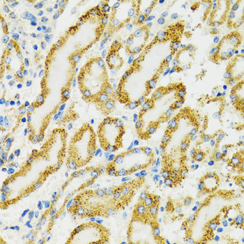 Immunohistochemistry of paraffin-embedded Rat kidney using HSPA9 Polyclonal Antibody at dilution of  1:100 (40x lens).