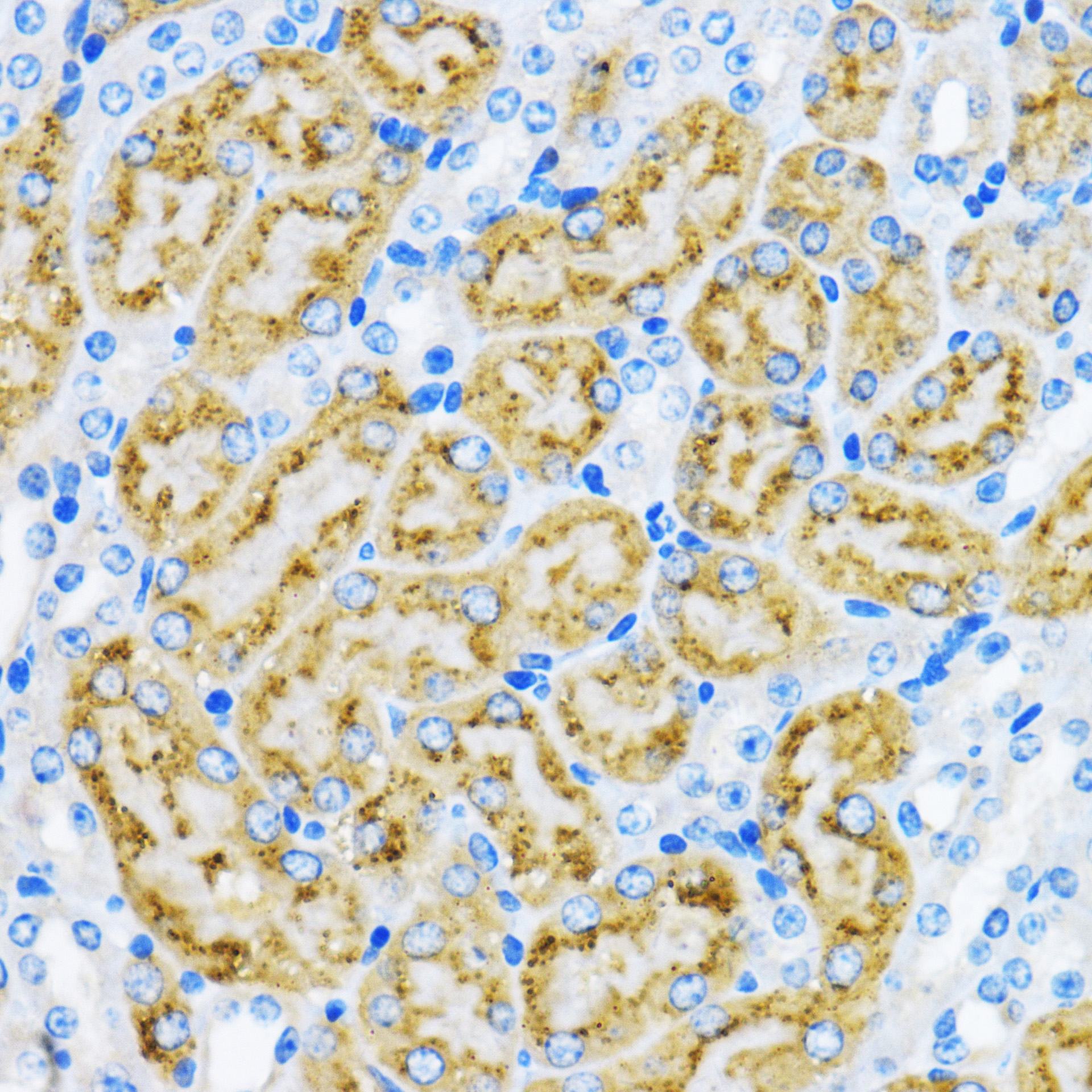 Immunohistochemistry of paraffin-embedded Mouse kidney using EEA1 Polyclonal Antibody at dilution of  1:100 (40x lens).