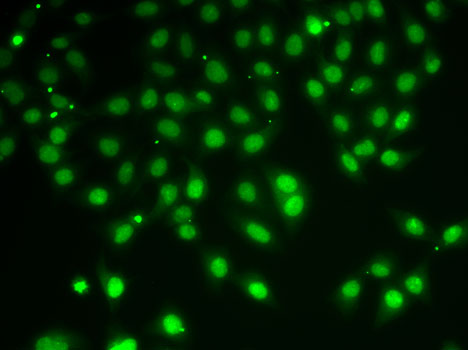 Immunofluorescence analysis of A-549 cells using HDAC5 Polyclonal Antibody