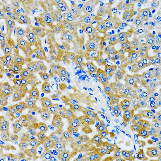 Immunohistochemistry of paraffin-embedded Rat liver using HDAC5 Polyclonal Antibody at dilution of  1:100 (40x lens).
