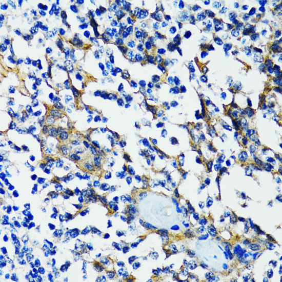 Immunohistochemistry of paraffin-embedded Human tonsil using HDAC5 Polyclonal Antibody at dilution of  1:100 (40x lens).