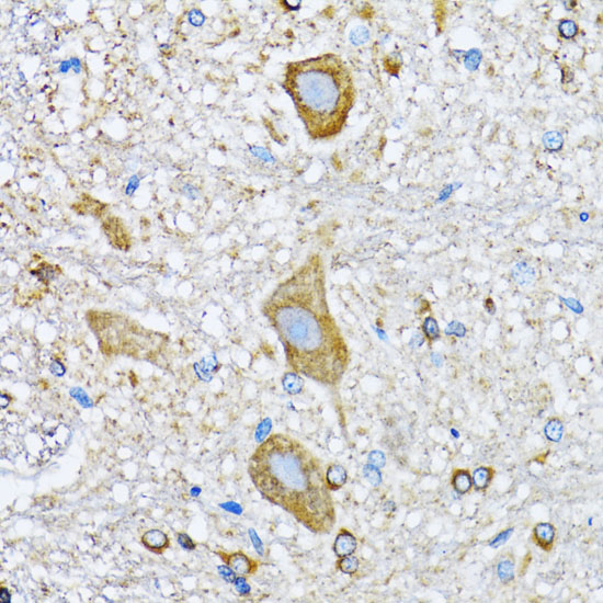 Immunohistochemistry of paraffin-embedded Mouse spinal cord using HDAC5 Polyclonal Antibody at dilution of  1:100 (40x lens).