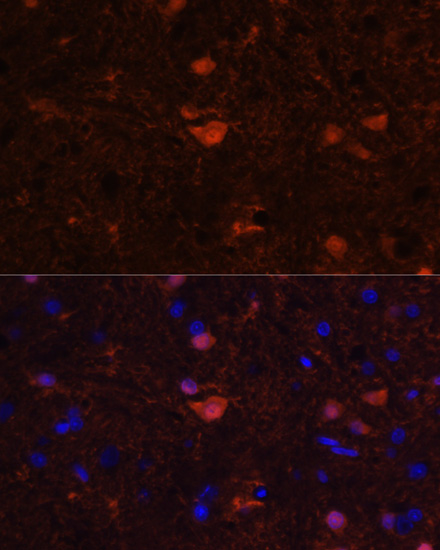 Immunofluorescence analysis of Rat brain using S100B Polyclonal Antibody at dilution of  1:100. Blue: DAPI for nuclear staining.