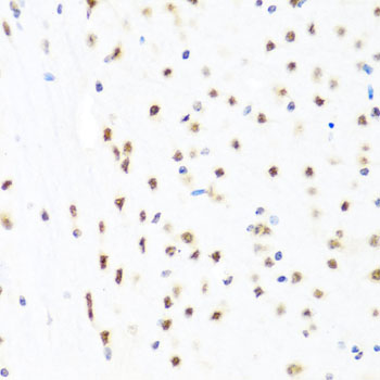 Immunohistochemistry of paraffin-embedded Mouse brain using GATA2 Polyclonal Antibody at dilution of  1:100 (40x lens).