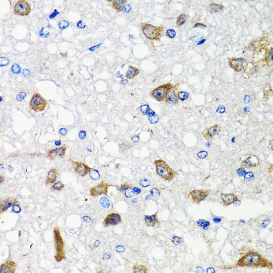 Immunohistochemistry of paraffin-embedded Rat brain using ACVR1C Polyclonal Antibody at dilution of  1:100 (40x lens).