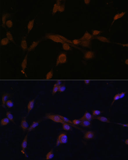 Immunofluorescence analysis of NIH/3T3 cells using ATG7 Polyclonal Antibody at dilution of  1:100. Blue: DAPI for nuclear staining.