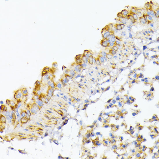 Immunohistochemistry of paraffin-embedded Mouse lung using ATG7 Polyclonal Antibody at dilution of  1:100 (40x lens).