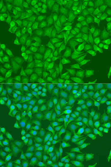 Immunofluorescence analysis of U2OS cells using CBL Polyclonal Antibody at dilution of  1:100. Blue: DAPI for nuclear staining.