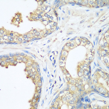 Immunohistochemistry of paraffin-embedded Human prostate using CBL Polyclonal Antibody at dilution of  1:200 (40x lens).