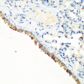 Immunohistochemistry of paraffin-embedded Mouse lung using CBL Polyclonal Antibody at dilution of  1:200 (40x lens).